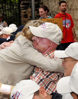 Foto: Una mujer abraza a un hombre que lleva una gorra. Tiene cicatrices de quemaduras graves en la cara, las orejas y las manos.
